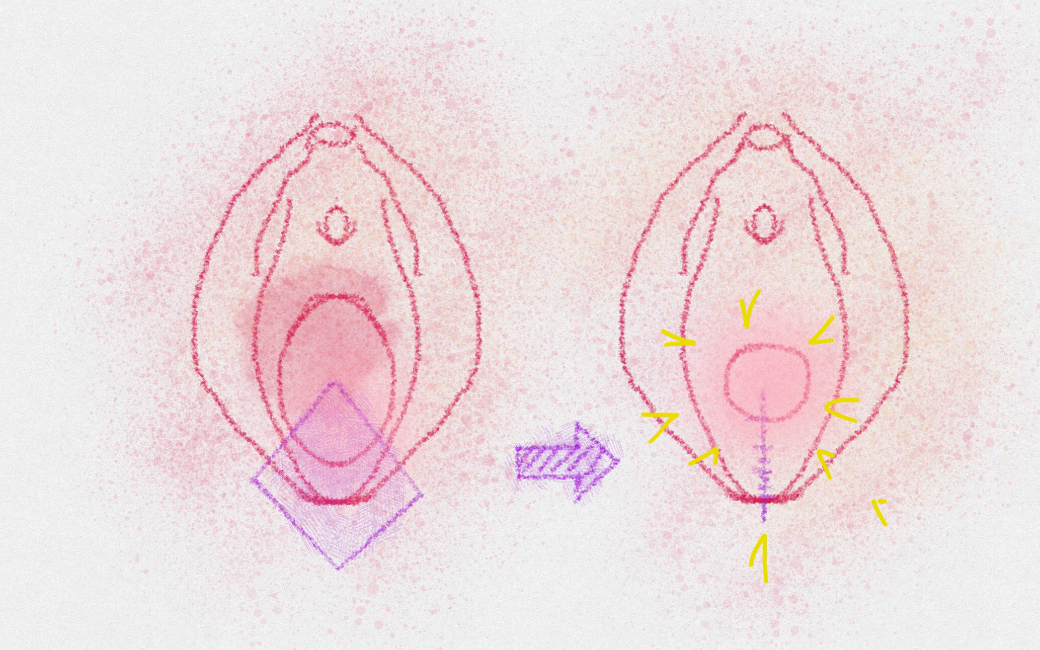 会陰部イメージ