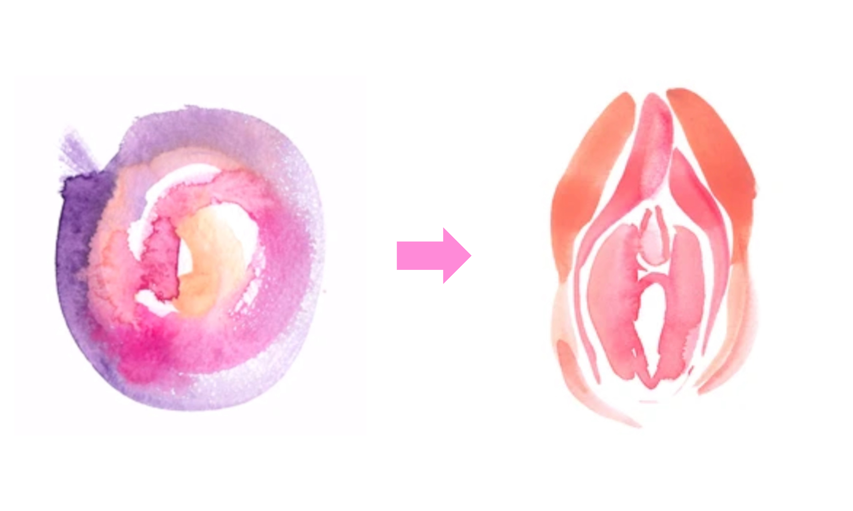 処女膜形成（再生）術のイメージ画像